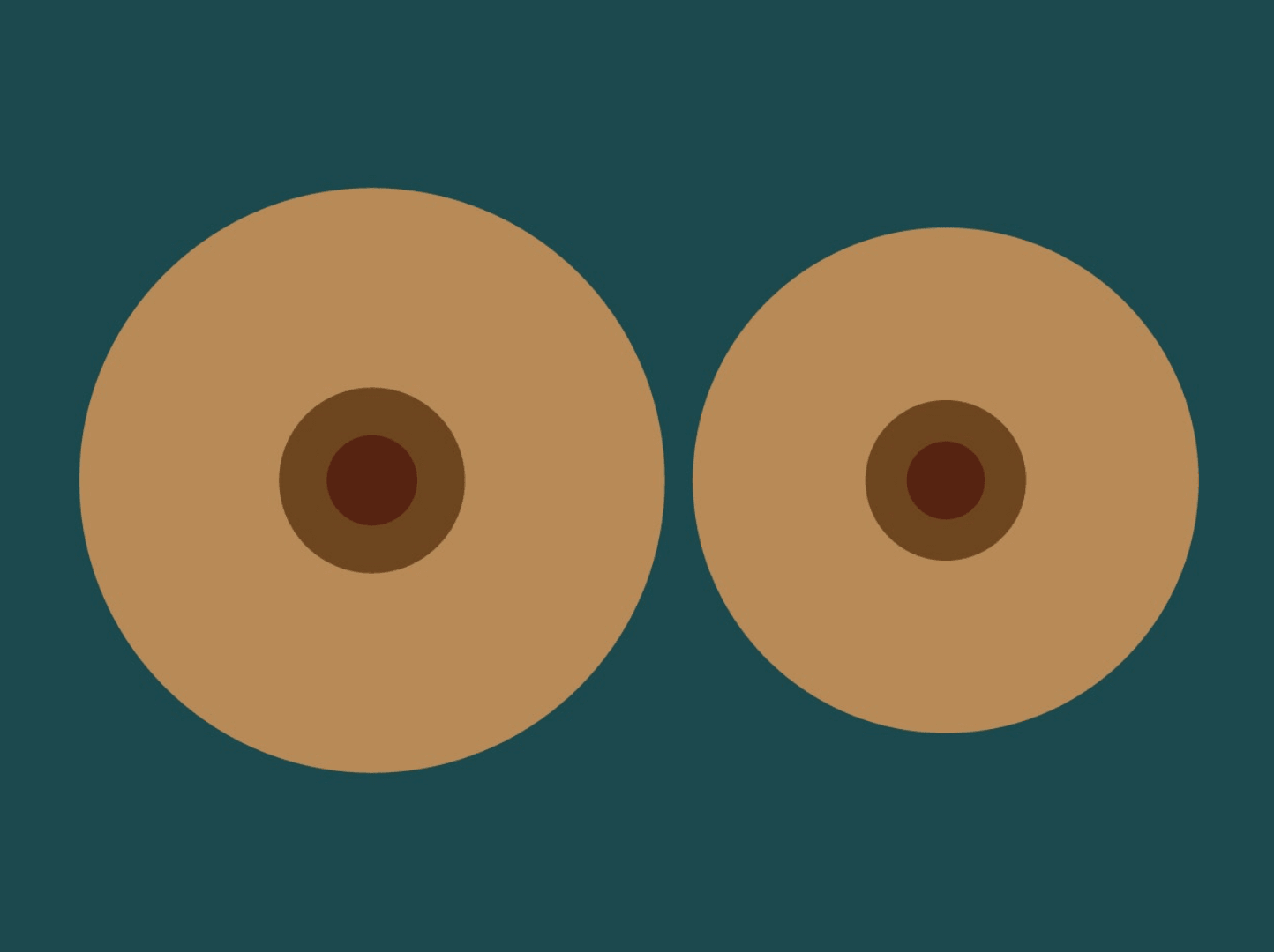 Which mastectomy bras are considered best for post-surgery recovery? - Myya